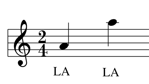 La posizione dei LA